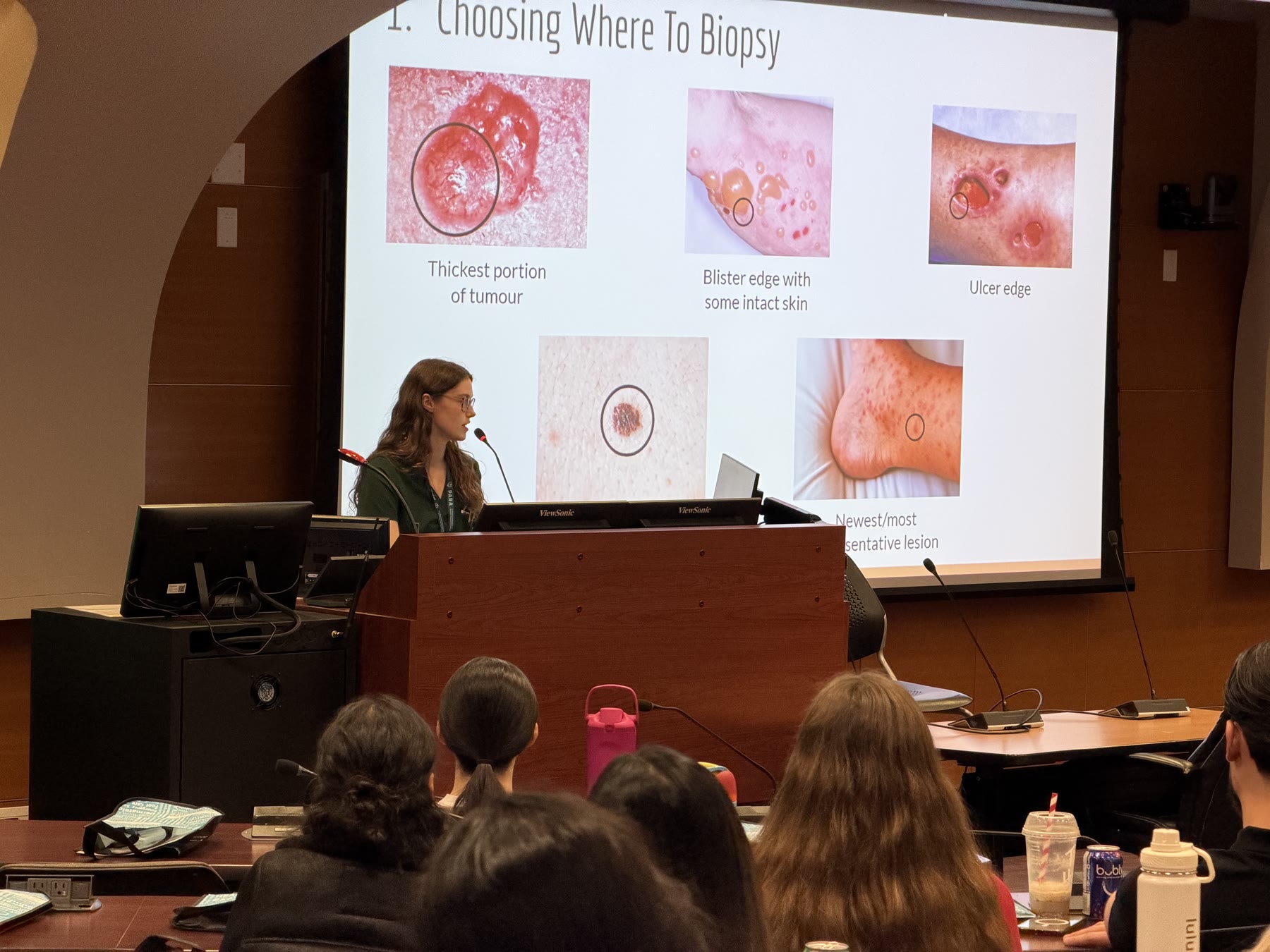 A speaker presenting a teaching session on choosing a biopsy site in dermatology